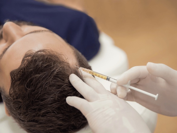 SAY GOODBYE TO HAIR LOSS WITH PRP AND GFC THERAPY: